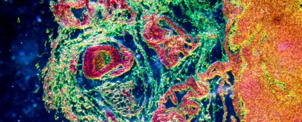 Hoe wetenschappers de verborgen uitknop voor ontstekingen in ons lichaam vonden - image 1