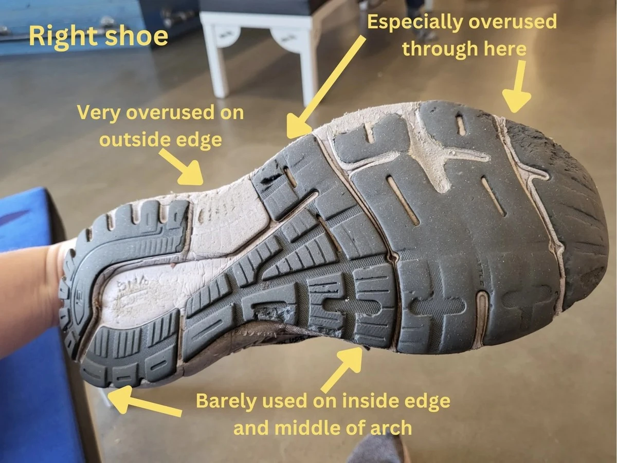 Waarom je schoenzolen sneller slijten aan de binnenkant (en wat dat zegt over je kniepijn) - image 1